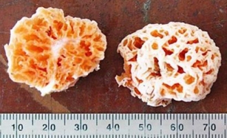 2012十大新物种之一——海绵宝宝蘑菇 ()
