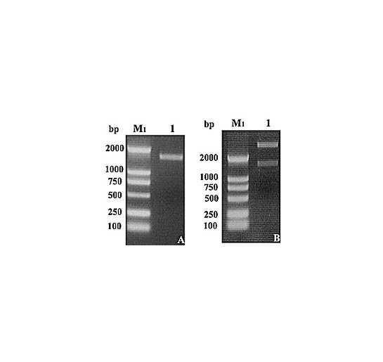 嗜热毛壳菌CT2纤维二糖水解酶Ⅰ在毕赤酵母中的高效表达