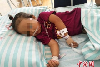 云南食用野生菌中毒女童成功转院 肝功能受损须透析